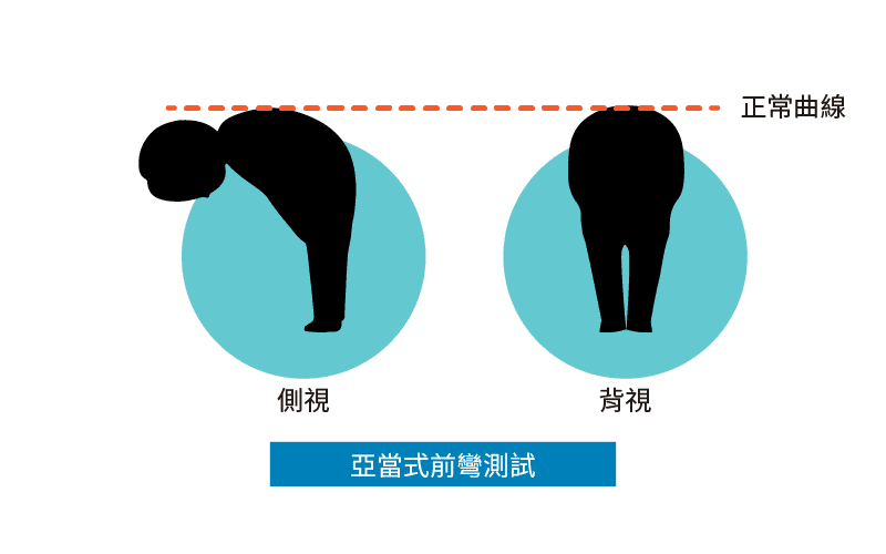 亞當式前彎檢測