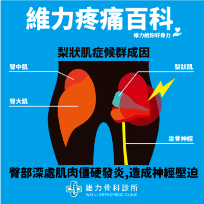 梨狀肌位置