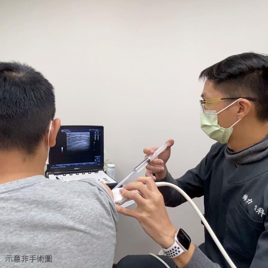 肩關節囊擴張術